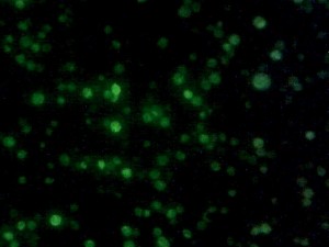 Yeast with nuclear GFP marker.